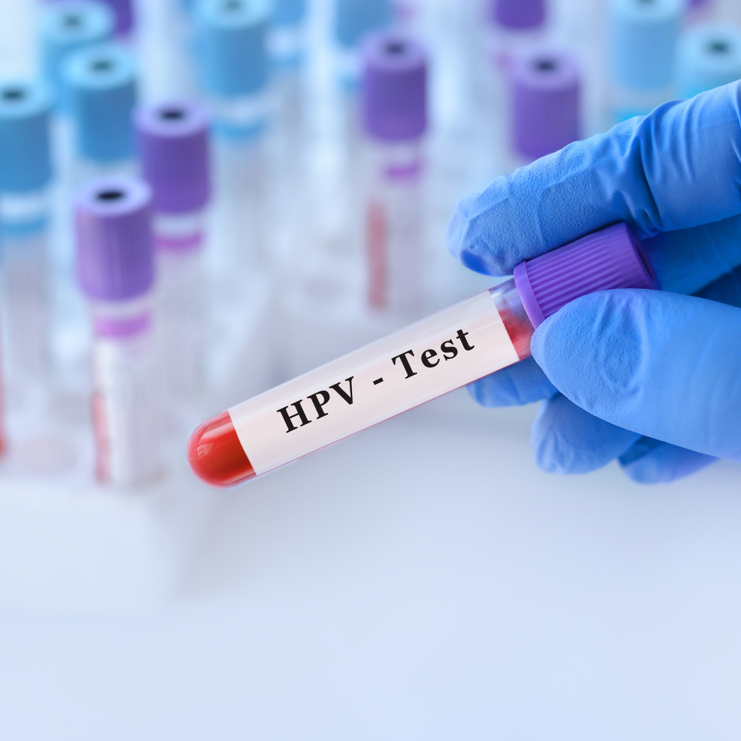 HPV Screening